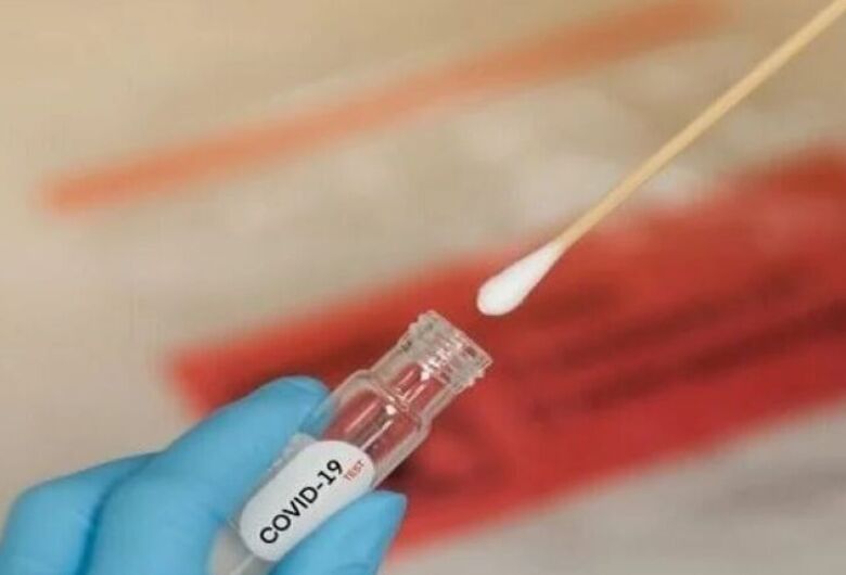 covid-teste-dourados-news-ses-1-1